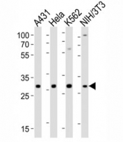 Western blot analysis of lysate from A431, HeLa, K562, mouse NIH3T3 cell line using CDK5 antibody