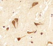 IHC analysis of FFPE human brain section using OTX2 antibody; Ab was diluted at 1:25.
