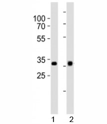 Western blot analysis of lysate from 1) HepG2 and 2) Y79 cell line using OTX2 antibody at 1:1000.~