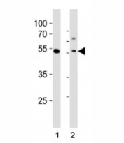 Western blot analysis of lysate from 1) human MCF-7 cell line and 2) mouse liver tissue tissue using Gata6 antibody at 1:1000. Predicted molecular weight: 60, 45 kDa (isoforms 1, 2).