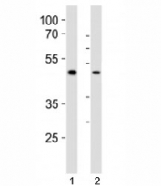 Western blot analysis of lysate from 1) human LNCaP and 2) mouse F9 cell line using Sox17 antibody at 1:1000. Predicted molecular weight ~45 kDa