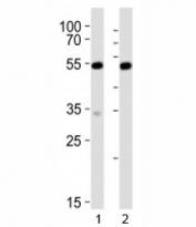 Western blot analysis of lysate from 1) mouse NIH3T3 and 2) rat C6 cell line using Srf antibody at 1:1000. Predicted molecular weight: ~52/60-70kDa (unmodified/phosphorylated).