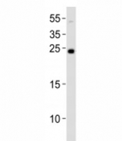 Western blot analysis of lysate from NCCIT cell line using LIN28A antibody at 1:1000. Predicted molecular weight ~23 kDa.