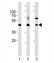 Western blot analysis of lysate from 1) mouse kidney, 2) mouse thymus and 3) rat lung tissue lysate using Dlk1 antibody. Observed molecular weight 41~60 kDa depending on glycosylation level.