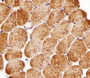 Immunohistochemical analysis of paraffin-embedded human skeletal muscle using Raptor antibody at 1:25 dilution.