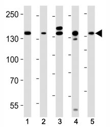 Western blot analysis of lysate from (1) HeLa, (2) MCF-7, (3) mouse C2C12, (4) mouse NIH3T3, (5) rat C6 cell line using Raptor antibody at 1:1000. Predicted molecular weight ~ 149 kDa.~