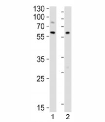 Western blot analysis of lysate from 1) Raji and 2) Ramos cell lines using LYN antibody at 1:1000. Predicted molecular weight 56/58 kDa (isoforms 1/2).