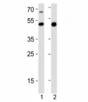 Western blot analysis of lysate from 1) mouse heart and 2) rat stomach tissue lysate using Gata6 antibody at 1:1000. Predicted molecular weight: 60, 45 kDa (isoforms 1, 2).
