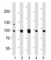 Western blot analysis of lysate from mouse 1) NIH3T3 cell line, 2) brain, 3) heart, 4) pancreas and 5) rat brain tissue lysate using Ephb1 antibody at 1:1000.