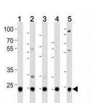 Western blot analysis of lysate from HeLa (1), HepG2 (2), Jurkat (3), mouse liver (4) , rat kidney  (5) lysate using UBB/ Ubiquitin antibody at 1:1000.