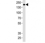 Western blot analysis of lysate from rat brain tissue using Insrr antibody at 1:1000. Expected size: ~80 kDa, 144 kDa.