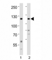 Western blot analysis of lysate from 1) human HeLa and 2) human SH-SY5Y cell line using Ror2 antibody at 1:1000.