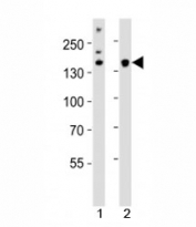 Western blot analysis of lysate from 1) HeLa cell line and 2) mouse cerebellum tissue using Kdm6b antibody at 1:1000. Predicted molecular weight ~176 kDa.