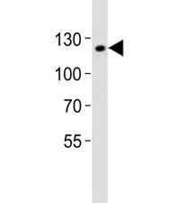 Western blot analysis of lysate from mouse F9 cell line using SIRT1 antibody at 1:1000. Visualized from 80~120 kDa depending on post-translational modifications