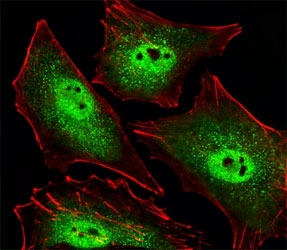 Fluorescent image of A549 cells stained with SIRT1 antibody. Ab was diluted at 1:25 dilution. An Alexa Fluor 488-conjugated goat anti-rabbit lgG was used as the secondary Ab (green). Cytoplasmic actin was counterstained with Alexa Fluor 555 conjugated with Phalloidin (red).