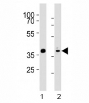 Western blot analysis of lysate from mouse stomach, rat heart tissue (left to right) using Mouse Nkx2.5 antibody at 1:1000 for each lane. Predicted molecular weight ~35 kDa, routinely observed at 35~45 kDa.