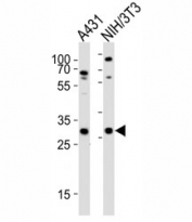 Western blot analysis of lysate from A431, mouse NIH3T3 cell line using CDK5 antibody diluted at 1:1000.