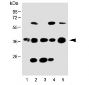 Western blot testing of human 1) THP-1, 2) HACAT, 3) K562, 4) U266 and 5) brain lysate with CCR2 antibody. 