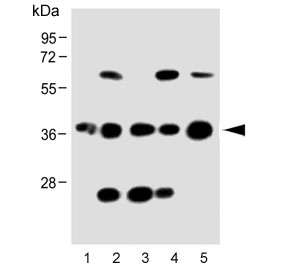 Western blot testing of human 1) THP-1, 2) HACAT, 3) K562, 4) U266 and 5) brain lysate with CCR2 antibody.