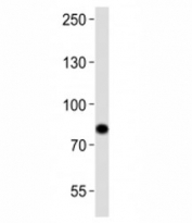 Western blot analysis of lysate from Ramos cell line using SYK antibody at 1:1000. Predicted molecular weight ~72 kDa