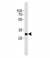 Western blot analysis of lysate from mouse kidney tissue using Hes1 antibody diluted at 1:1000. Predicted molecular weight: 30-35 kDa.