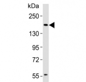 Western blot analysis of lysate MCF-7 cells using Insulin Receptor Related antibody at 1:1000. Expected molecular weight: ~80 kDa, 144 kDa.