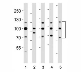 Western blot analysis of lysate from (1) HeLa, (2) HepG2, (3) MCF-7, (4) SH-SY5Y, (5) mouse NIH3T3 cell line using FGFR antibody at 1:1000. Predicted molecular weight: 75-160 kDa depending on glycosylation level.~
