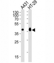 Western blot analysis of lysate from A431, HT-29 cell line (left to right) using Ep-CAM antibody diluted at 1:1000 for each lane. Expected molecular weight: ~35 kDa (unmodified), 40-43 kDa (glycosylated).