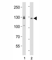 Western blot analysis of lysate from (1) A431 and (2) U-87 MG cell line using EPHA2 antibody diluted at 1:1000.