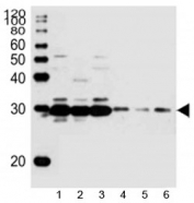 Western blot analysis of lysate from mouse 1) heart, 2) liver, 3) rat heart, and human 4) HL-60, 5) A431, 6) HepG2 cell line using Sdhb antibody at 1:1000. Predicted molecular weight 25-32 kDa.