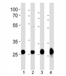 Western blot analysis of lysate from mouse 1) heart, 2) liver, 3) rat heart, 4) zebrafish heart tissue using Sdhb antibody at 1:1000. Predicted molecular weight 25-32 kDa.~
