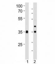 Western blot analysis of lysate from 1) human HeLa and 2) mouse NIH3T3 cell line using WDR5 antibody at 1:1000. Predicted molecular weight ~36 kDa.