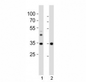 Western blot analysis of lysate from 1) human liver tissue and 2) mouse NIH3T3 cell line using Wdr5 antibody at 1:1000. Predicted molecular weight ~36 kDa.