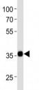 Western blot analysis of lysate from NCCIT cell line using SOX2 antibody at 1:1000.