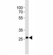 Western blot analysis of lysate from human skeletal muscle tissue lysate using Olig3 antibody. Ab was diluted at 1:1000.