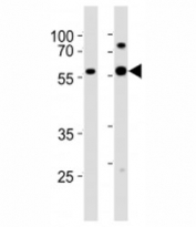 Western blot analysis of lysate from 1) HeLa and 2) MCF-7 cell line using GATA6 antibody at 1:1000. Predicted molecular weight: 60, 45 kDa (isoforms 1, 2).