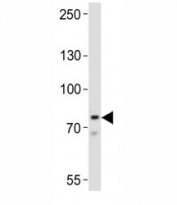 Western blot analysis of lysate from Ramos cell line using BTK antibody at 1:1000.