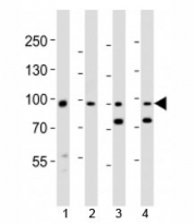 Western blot analysis of lysate from 1) human A431, 2) mouse NIH3T3 cell line, 3) mouse brain and 4) rat brain tissue lysate using Ephb1 antibody at 1:1000.