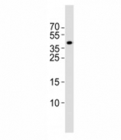 Western blot analysis of lysate from rat brain tissue lysate using Isl1 antibody at 1:1000. Predicted molecular weight ~39 kDa.