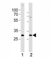 Western blot analysis of lysate from (1) SH-SY5Y and (2) MCF-7 cell line using HES1 antibody at 1:1000. Predicted molecular weight: 30-35 kDa.