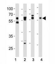 Western blot analysis of lysate from (1) HeLa, (2) mouse NIH3T3, (3) mouse C2C12, and (4) rat PC-12 cell line using SMAD2 antibody at 1:1000. Predicted molecular weight: 52~60 kDa.
