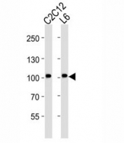 Western blot analysis of lysate from C2C12, L6 cell line (left to right) using Musk antibody at 1:2000 for each lane.