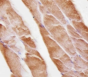 Immunohistochemical analysis of paraffin-embedded mouse skeletal muscle using Musk antibody at 1:25 dilution.~