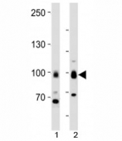 Western blot analysis of lysate from 1) MCF-7 cells and 2) human brain tissue using TLE1 antibody at 1:1000.