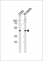 Western blot analysis of lysate from CEM cell line, mouse testis tissue lysate (left to right) using Lhx1 antibody diluted at 1:1000 for each lane.