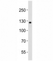 Western blot analysis of lysate from K562 cell line using LIFR antibody diluted at 1:1000. Expected/observed molecular weight ~124/190kDa (unmodified/glycosylated).