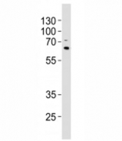 Western blot analysis of lysate from A549 cell line using p62 antibody at 1:1000. Observed molecular weight ~62 kDa.