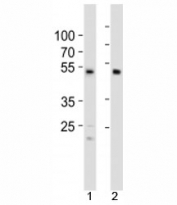 Western blot analysis of lysate from 1) HCT116 cell line and 2) human heart tissue using SOX7 antibody at 1:1000. Predicted molecular weight: 42/49 kDa (isoforms 1/2).