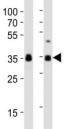 Western blot analysis of lysate from human NCCIT, mouse F9 cell line (left to right) using anti-SOX2 antibody at 1:1000 for each lane.