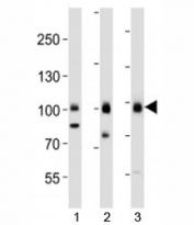 Western blot analysis of lysate from 1) HepG2, 2) MCF-7 cell line and 3) human brain tissue using TLE1 antibody at 1:1000.
